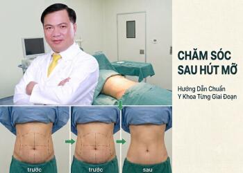 Hướng dẫn chăm sóc sau hút mỡ chuẩn y khoa từng giai đoạn